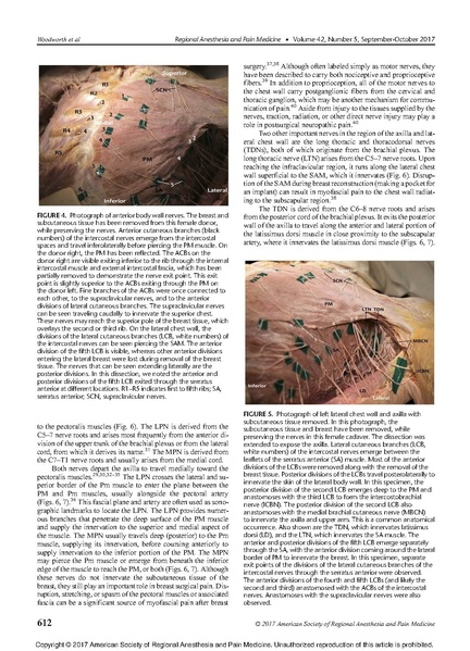 File:11-27 Breast analgesia.pdf