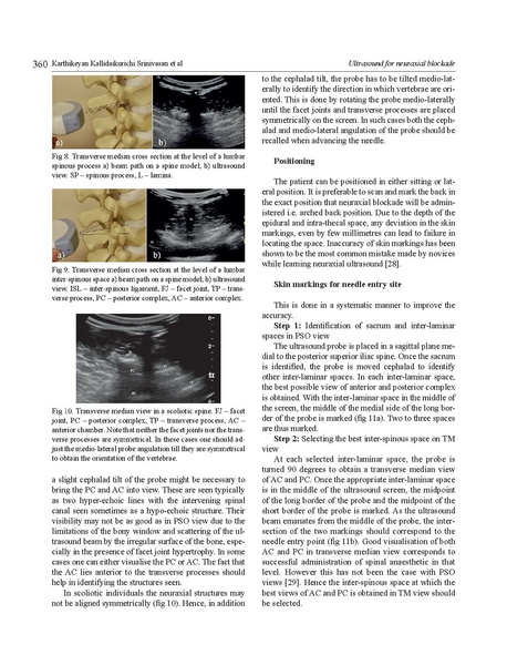 File:11-27 US for CNB Handout,.pdf