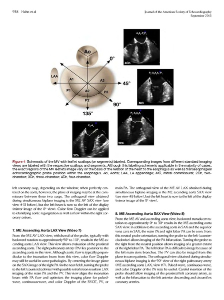 File:ASE 2013 Performing-Comprehensive-TEE.pdf