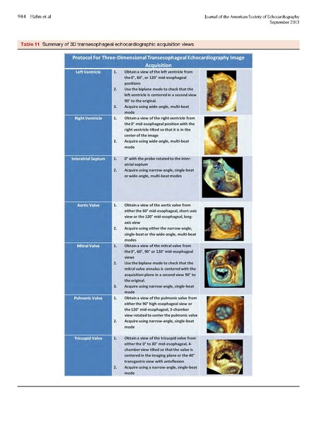 File:ASE 2013 Performing-Comprehensive-TEE.pdf