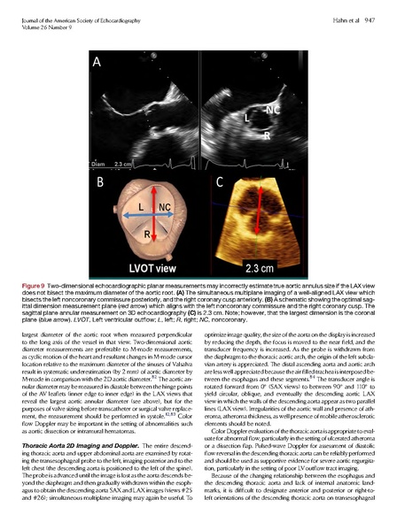 File:ASE 2013 Performing-Comprehensive-TEE.pdf