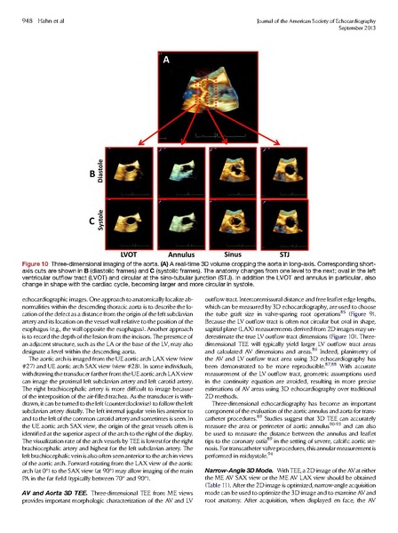 File:ASE 2013 Performing-Comprehensive-TEE.pdf