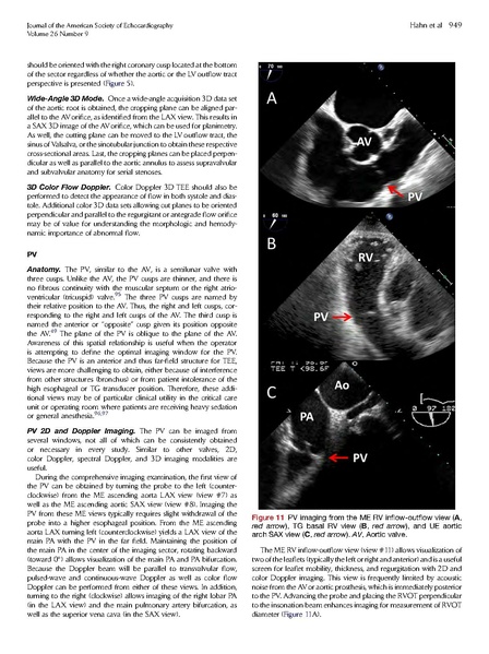 File:ASE 2013 Performing-Comprehensive-TEE.pdf