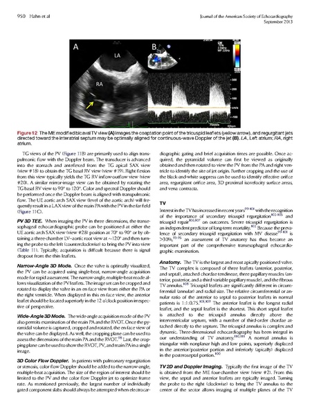 File:ASE 2013 Performing-Comprehensive-TEE.pdf