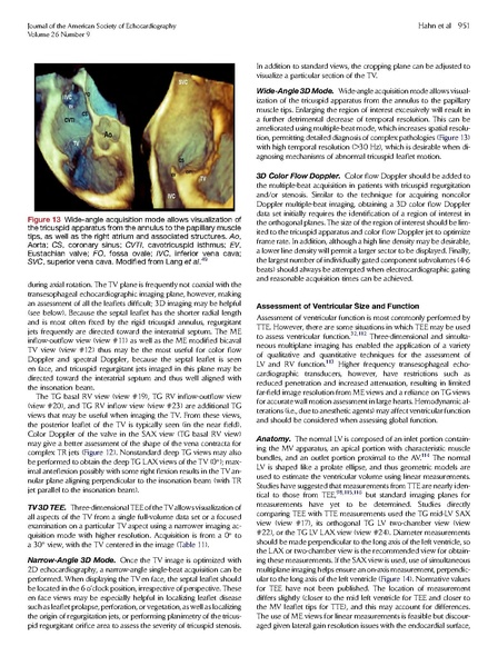 File:ASE 2013 Performing-Comprehensive-TEE.pdf