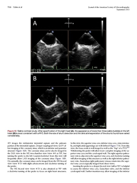 File:ASE 2013 Performing-Comprehensive-TEE.pdf