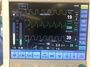 Aisys machine monitors.png