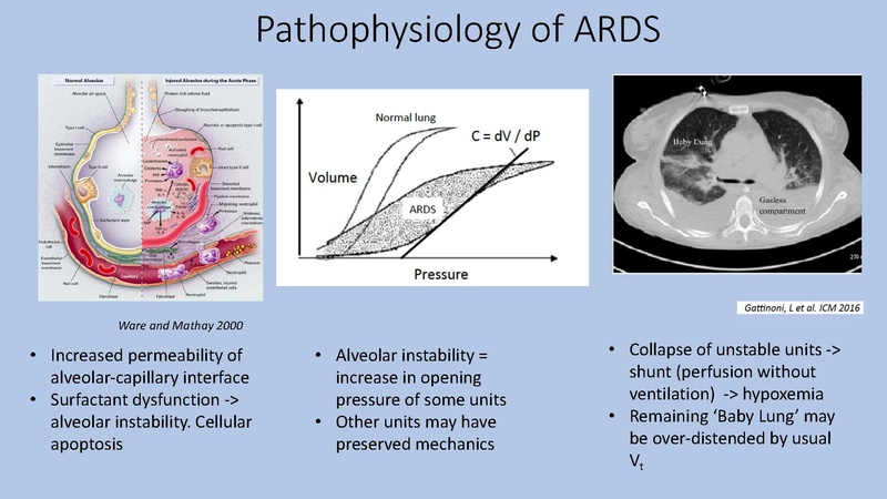 File:Anesthesia Lecture COVIDICU.pdf