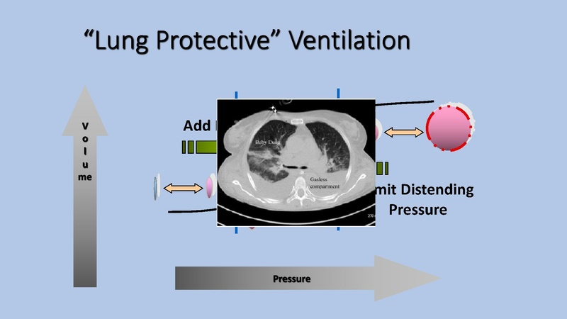 File:Anesthesia Lecture COVIDICU.pdf