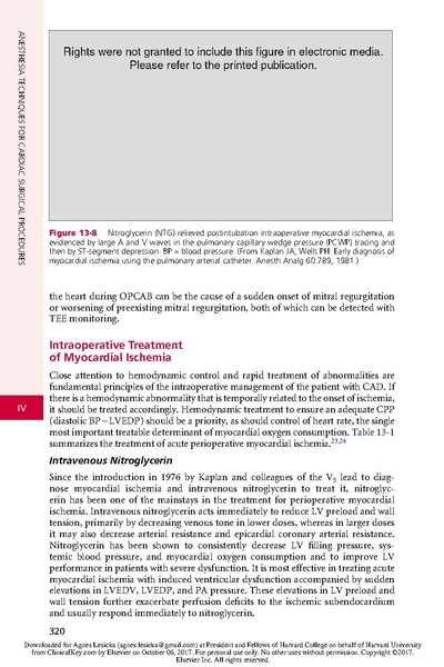 File:Anesthesia for Myocardial Revascularization.pdf