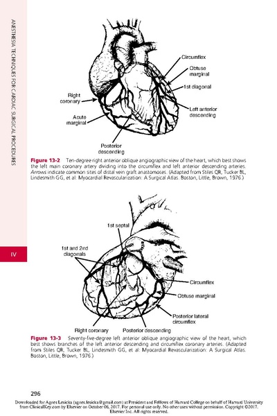 File:Anesthesia for Myocardial Revascularization.pdf