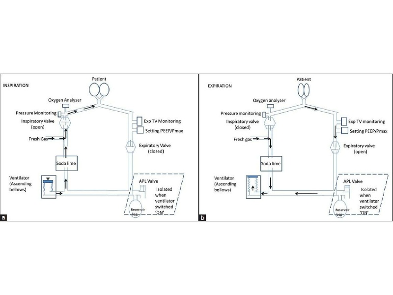 File:Anesthesia machine review.pdf