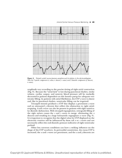 File:Art&CVP monitoring.pdf