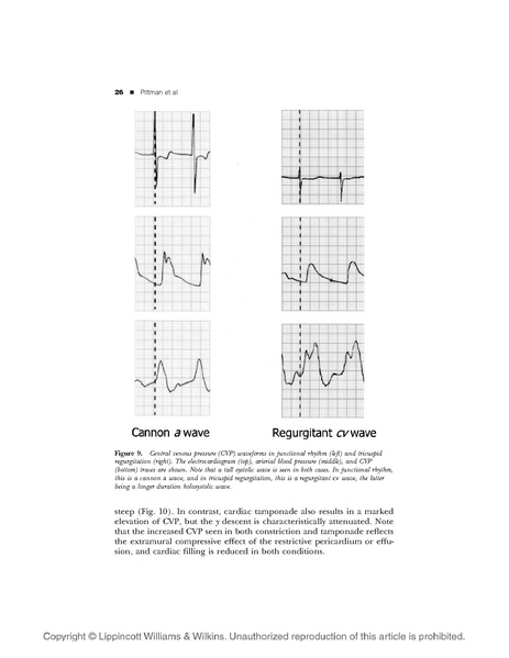File:Art&CVP monitoring.pdf