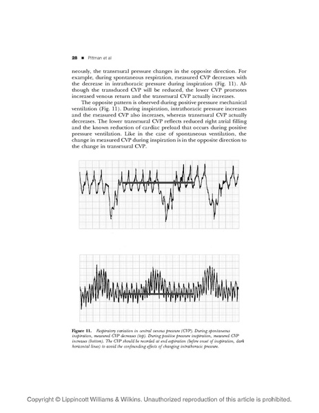 File:Art&CVP monitoring.pdf
