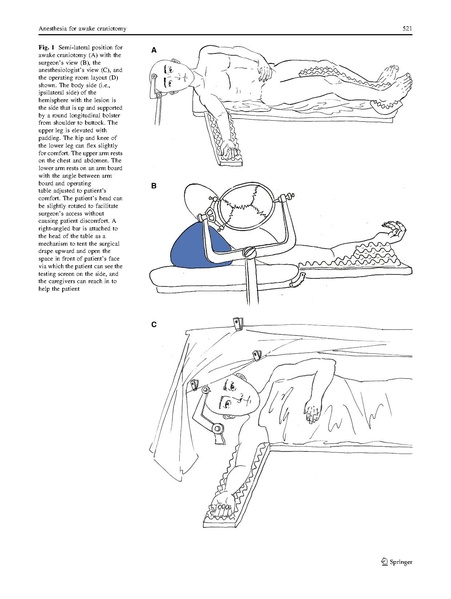 File:Awake Crani guide Meng and Gelb Can J Anaesth 2017.pdf