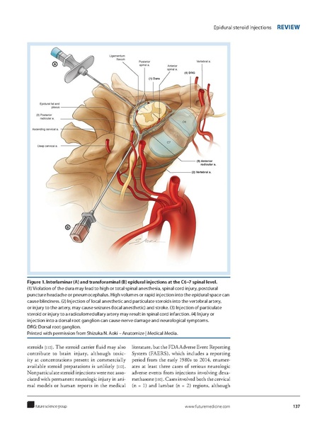 File:Bicket - Epidural steroid injections an updated review.pdf