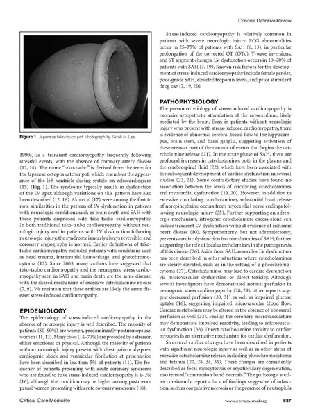 File:Boland Concise Definitive Review 2015 Stress Induced Cardiomyopathy.pdf