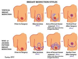 Breast anatomy 2.jpg