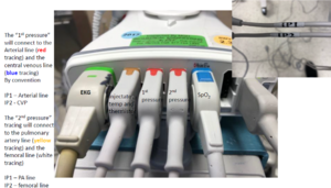 Brick connections.png