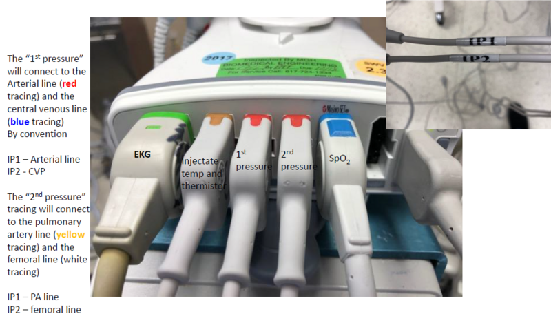 File:Brick connections.png