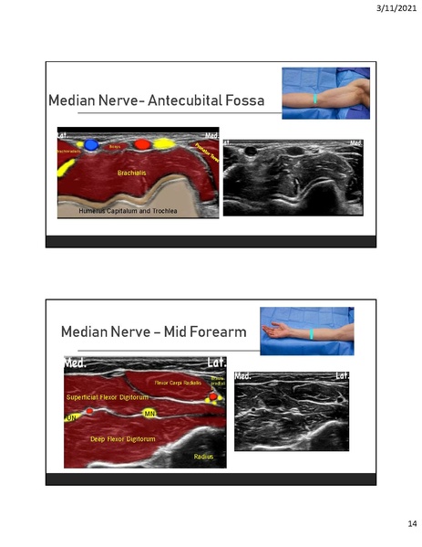 File:CA1 - Introduction to Regional.pdf