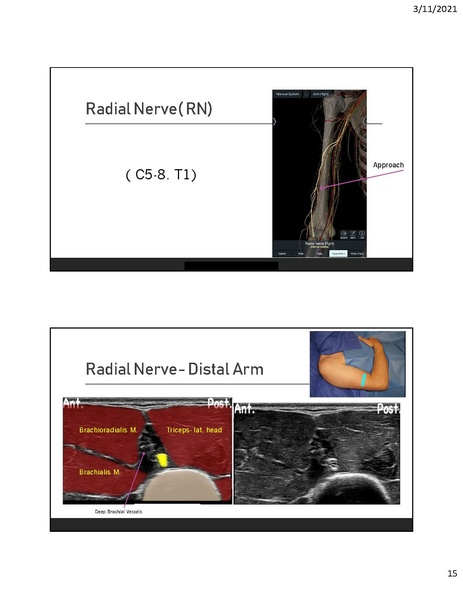 File:CA1 - Introduction to Regional.pdf