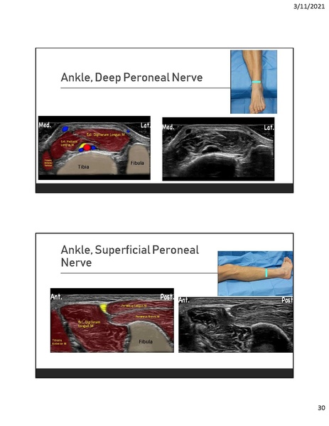File:CA1 - Introduction to Regional.pdf