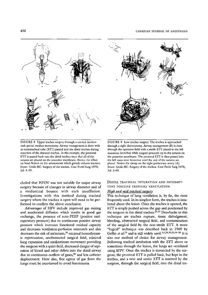 File:CJA - Trach R&R.pdf