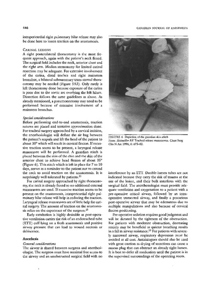 File:CJA - Trach R&R.pdf