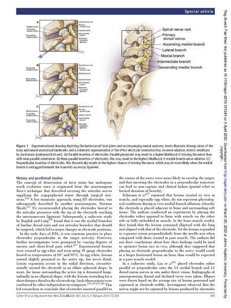File:Cohen - Lumbar Facet Guidelines.pdf