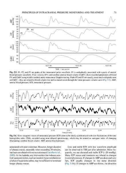 File:Czosnyka 2017 Handbook of Clin Neurology - Increased ICP Management.pdf