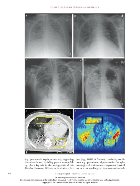 File:Drazen NEJM 2017 - Acute Respiratory Distress Syndrome.pdf