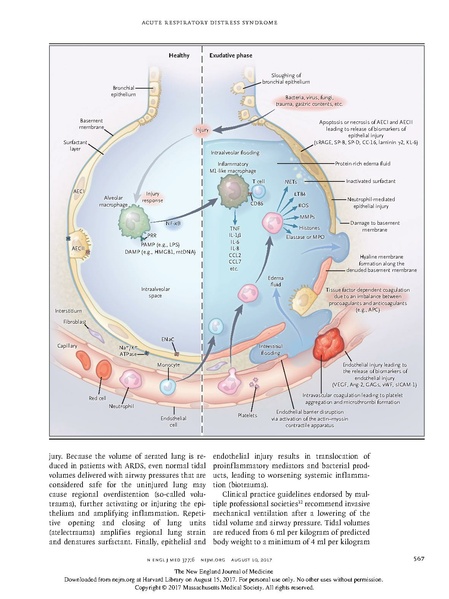 File:Drazen NEJM 2017 - Acute Respiratory Distress Syndrome.pdf