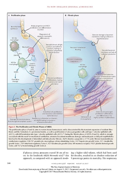 File:Drazen NEJM 2017 - Acute Respiratory Distress Syndrome.pdf