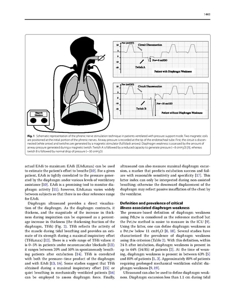 File:Dres Intensive Care Med 2017 - Critical Illness Diaphragm Atrophy.pdf