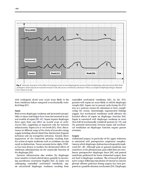 File:Dres Intensive Care Med 2017 - Critical Illness Diaphragm Atrophy.pdf