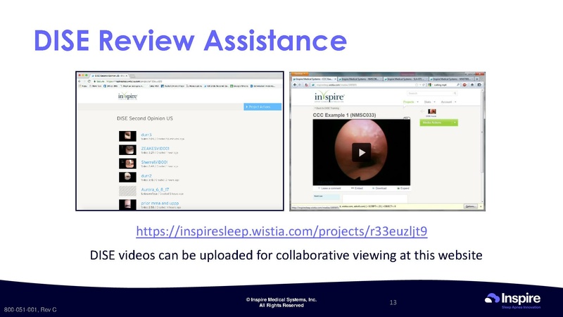 File:Drug Induced Sleep Endoscopy.pdf