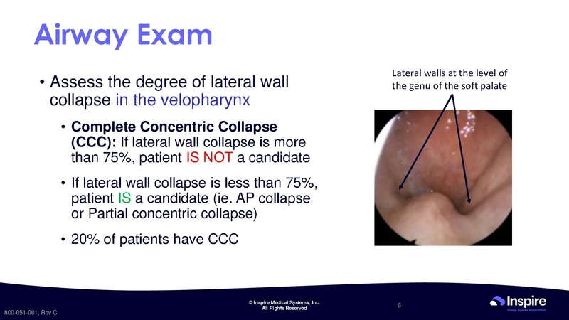 File:Drug Induced Sleep Endoscopy.pdf