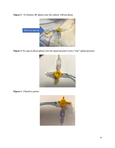 File:E4 SICU Spinal Drain Management Protocol.2019.pdf