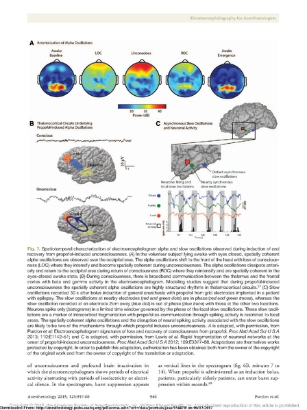 File:EEG Interpretation Anesthesiology 2015.pdf