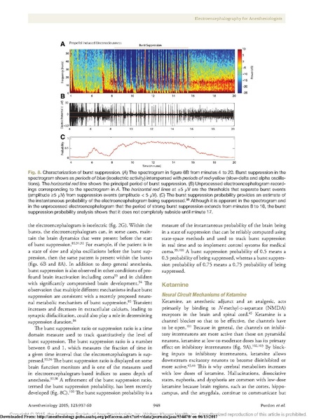 File:EEG Interpretation Anesthesiology 2015.pdf