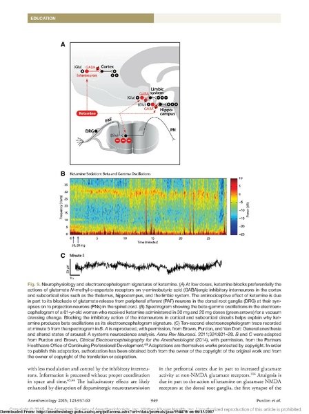 File:EEG Interpretation Anesthesiology 2015.pdf