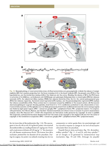 File:EEG Interpretation Anesthesiology 2015.pdf