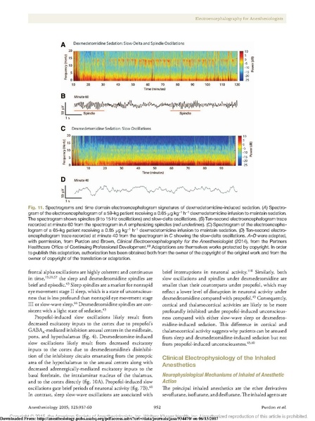 File:EEG Interpretation Anesthesiology 2015.pdf