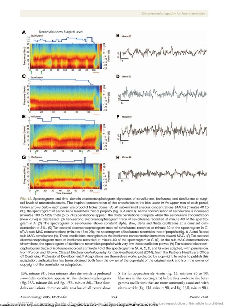 File:EEG Interpretation Anesthesiology 2015.pdf