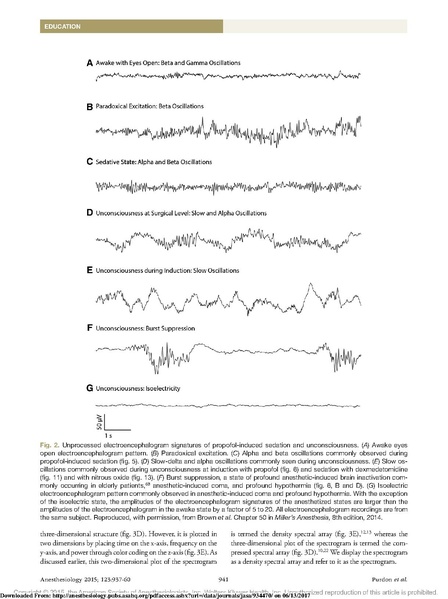File:EEG Interpretation Anesthesiology 2015.pdf