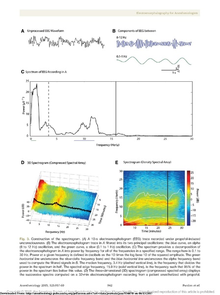 File:EEG Interpretation Anesthesiology 2015.pdf