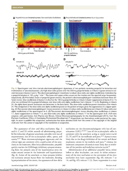 File:EEG Interpretation Anesthesiology 2015.pdf