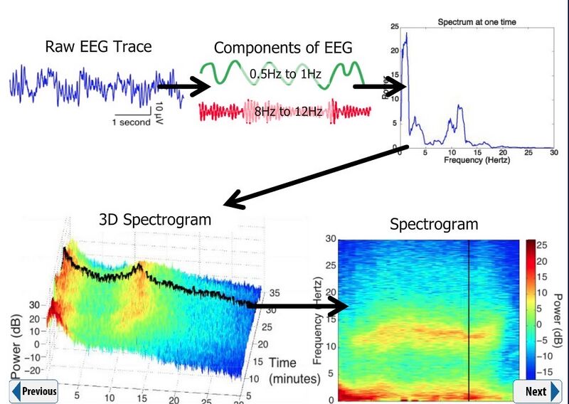 File:EEG Spectrogram Components.jpg